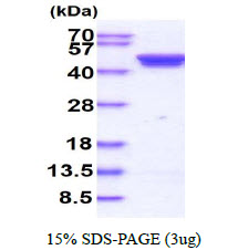 Human Casein Kinase 2 alpha (CK2 alpha)