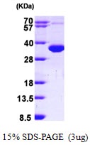Human Copper Chaperone For Superoxide Dismutase (CCS)
