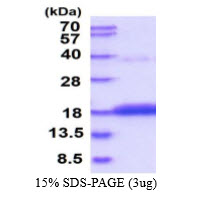 Human Cytidine Deaminase (CDA)