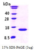 Human Cystatin-B (CSTB)