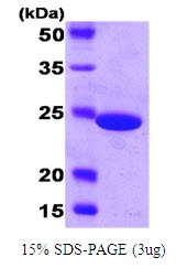 Carbonic Anhydrase 2 (CA2)