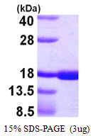 Human CD40L