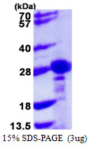 Human CBX1