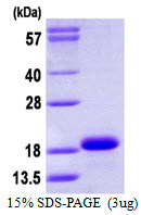 Human Cytochrome b5