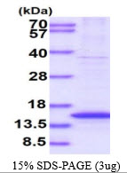 Human CENPH