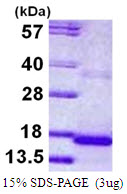 Human Cystatin-9 (CST9)