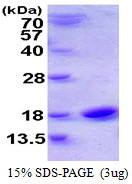 Human Cystatin-SN (CST1)