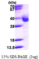 Human Diaphorase 1 (CYB5R3)