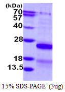 Human CSRP2