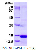 Human Cystatin S
