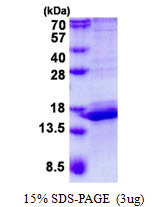 Human Calmodulin-Like Protein 3 (CALML3)