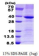 Human Cathepsin S (CTSS)