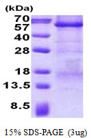 Human Carboxypeptidase E (CPE)