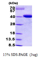Human Coproporphyrinogen Oxidase