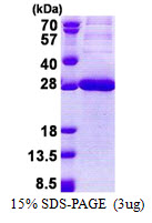 Human Carcinoembryonic Antigen Related Cell Adhesion Molecule 21 (CEACAM21)