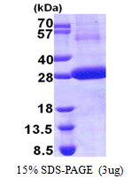 Human Cathepsin F (CTSF)
