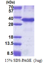 Human Cathepsin Z (CTSZ)