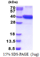 Human Cyclin-Dependent Kinase 16 (CDK16)