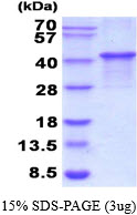 Human Carbonic Anhydrase 14 (CA14)