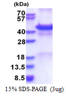 Human Calreticulin-3 (CALR3)