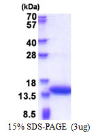 Human Calponin 2