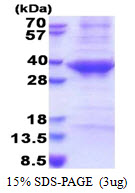 Human Cathepsin E (CTSE)