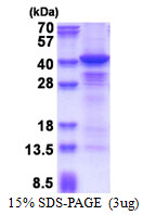Human Casein Kinase 1 alpha