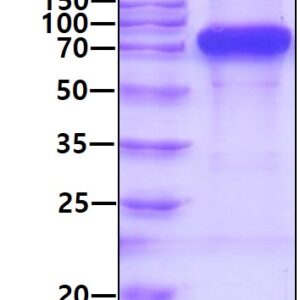 Human Complement C9