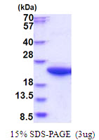 Human Calpain small subunit 1