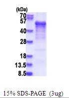 Human Casein Kinase 1 delta