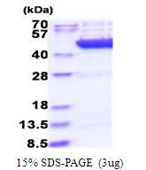 Human Citrate Synthase