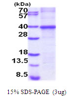 Human Connective Tissue Growth Factor (CTGF)