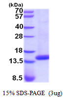 Human Cystatin-D (CST5)