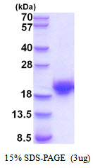 Human Cystatin-F (CST7)