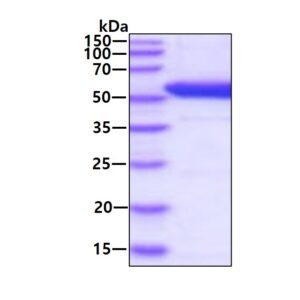 Human DOPA Decarboxylase (DDC)