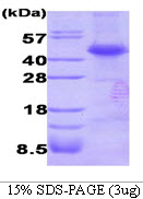 Human Dysbindin