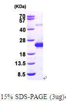 Human Deoxycytidylate deaminase (DCTD)