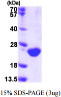 Human DUSP3