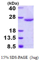 Human Dual Specificity Protein Phosphatase 18 (DUSP18)