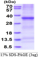 Human Decoy Receptor 3 (DcR3)