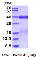 Human DcR1