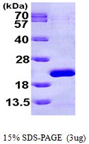 Human Eukaryotic Translation Initiation Factor 1A X-Linked (EIF1AX)