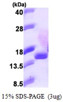 Human Eukaryotic Translation Initiation Factor 1B (EIF1B)