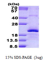 Human Endothelin-2