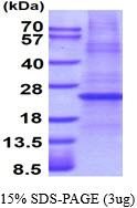 Human Erythropoietin