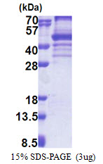 Human EBNA1BP2