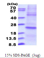 Human Dual Specificity Protein Phosphatase 22 (DUSP22)