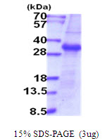 Human Enterokinase