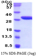 Human Erythropoietin Receptor (EPO-R)