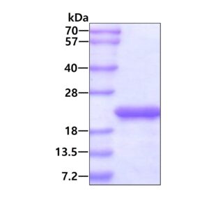 Human FTH1 (Ferritin Heavy Chain)